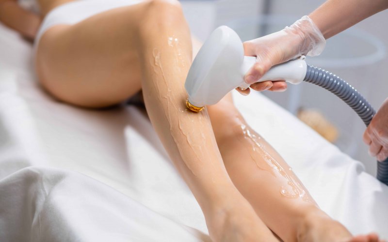 Lazer Epilasyon Nedir? Avantajları, Faydaları ve Süreç 